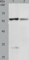 Prolylcarboxypeptidase antibody, TA322677, Origene, Western Blot image 
