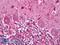 ADP/ATP translocase 3 antibody, LS-B8181, Lifespan Biosciences, Immunohistochemistry paraffin image 