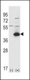 Glutamic-Oxaloacetic Transaminase 1 antibody, LS-C166582, Lifespan Biosciences, Western Blot image 