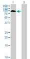 Zinc Finger And BTB Domain Containing 46 antibody, H00140685-B01P, Novus Biologicals, Western Blot image 