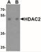 Histone Deacetylase 2 antibody, NBP2-41285, Novus Biologicals, Western Blot image 