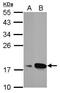 Anterior Gradient 3, Protein Disulphide Isomerase Family Member antibody, PA5-27222, Invitrogen Antibodies, Western Blot image 