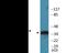 NFKB Inhibitor Epsilon antibody, EKC1945, Boster Biological Technology, Western Blot image 