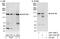 Nucleoporin 160 antibody, A301-790A, Bethyl Labs, Western Blot image 