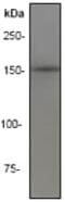 Insulin Receptor Substrate 1 antibody, ab40777, Abcam, Western Blot image 