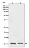 S100 Calcium Binding Protein A10 antibody, M02787, Boster Biological Technology, Western Blot image 