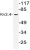 Potassium Voltage-Gated Channel Subfamily C Member 4 antibody, AP21098PU-N, Origene, Western Blot image 