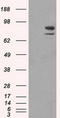 SATB Homeobox 1 antibody, TA500589, Origene, Western Blot image 