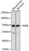 Retinoid X Receptor Beta antibody, 18-298, ProSci, Western Blot image 