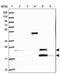 Elongator Acetyltransferase Complex Subunit 6 antibody, PA5-61225, Invitrogen Antibodies, Western Blot image 