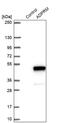 ADP-Ribose/CDP-Alcohol Diphosphatase, Manganese Dependent antibody, PA5-54740, Invitrogen Antibodies, Western Blot image 
