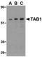 TGF-Beta Activated Kinase 1 (MAP3K7) Binding Protein 1 antibody, NBP1-76595, Novus Biologicals, Western Blot image 