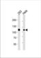 MutS Homolog 2 antibody, TA328162, Origene, Western Blot image 