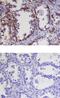 Kallikrein Related Peptidase 9 antibody, PA5-47497, Invitrogen Antibodies, Immunohistochemistry paraffin image 