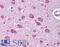 BR Serine/Threonine Kinase 1 antibody, LS-B181, Lifespan Biosciences, Immunohistochemistry paraffin image 