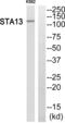 StAR Related Lipid Transfer Domain Containing 13 antibody, abx013866, Abbexa, Western Blot image 