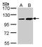 Trafficking Kinesin Protein 2 antibody, GTX107718, GeneTex, Western Blot image 