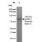 Gamma-Aminobutyric Acid Type A Receptor Alpha4 Subunit antibody, LS-C774137, Lifespan Biosciences, Western Blot image 