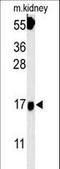 Fibroblast Growth Factor Binding Protein 3 antibody, LS-C166141, Lifespan Biosciences, Western Blot image 