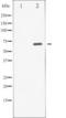 Spleen Associated Tyrosine Kinase antibody, TA325924, Origene, Western Blot image 