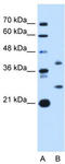ST8SiaII antibody, TA339031, Origene, Western Blot image 