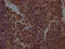 Caspase 2 antibody, CSB-RA782200A0HU, Cusabio, Immunohistochemistry paraffin image 