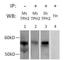 Tryptophan Hydroxylase 2 antibody, NB100-74555, Novus Biologicals, Immunoprecipitation image 