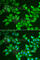 5'-Aminolevulinate Synthase 2 antibody, A6522, ABclonal Technology, Immunofluorescence image 