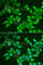 5-aminolevulinate synthase, erythroid-specific, mitochondrial antibody, A6522, ABclonal Technology, Immunofluorescence image 