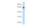 High molecular weight kininogen antibody, 30-095, ProSci, Western Blot image 