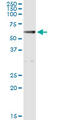 Aldehyde Dehydrogenase 1 Family Member A1 antibody, LS-B6003, Lifespan Biosciences, Immunoprecipitation image 