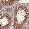 Eukaryotic Translation Initiation Factor 6 antibody, NBP2-13954, Novus Biologicals, Immunohistochemistry paraffin image 