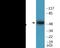 Tryptophan Hydroxylase 1 antibody, EKC2280, Boster Biological Technology, Western Blot image 