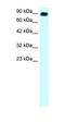 Apolipoprotein B MRNA Editing Enzyme Catalytic Subunit 3G antibody, orb324392, Biorbyt, Western Blot image 