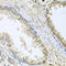 Cholesterol 24-hydroxylase antibody, A03772, Boster Biological Technology, Immunohistochemistry paraffin image 