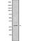 NSE2 (MMS21) Homolog, SMC5-SMC6 Complex SUMO Ligase antibody, abx217251, Abbexa, Western Blot image 