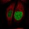 ATPase Family AAA Domain Containing 2 antibody, NBP1-84123, Novus Biologicals, Immunofluorescence image 