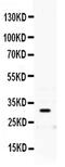 PRP antibody, PA5-79878, Invitrogen Antibodies, Western Blot image 