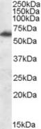 FTO Alpha-Ketoglutarate Dependent Dioxygenase antibody, EB08564, Everest Biotech, Western Blot image 