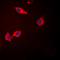 Serpin Family G Member 1 antibody, orb101493, Biorbyt, Immunocytochemistry image 