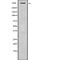 Abnormal Spindle Microtubule Assembly antibody, abx148377, Abbexa, Western Blot image 