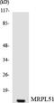 Mitochondrial Ribosomal Protein L51 antibody, LS-C200222, Lifespan Biosciences, Western Blot image 