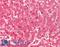 Cereblon antibody, LS-B16067, Lifespan Biosciences, Immunohistochemistry paraffin image 