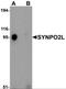 Synaptopodin 2 Like antibody, NBP2-82021, Novus Biologicals, Western Blot image 