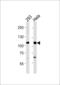 Spalt Like Transcription Factor 4 antibody, 58-071, ProSci, Western Blot image 