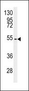 CCZ1 Homolog, Vacuolar Protein Trafficking And Biogenesis Associated antibody, LS-C168190, Lifespan Biosciences, Western Blot image 