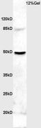 Glutamate Metabotropic Receptor 2 antibody, orb2751, Biorbyt, Western Blot image 
