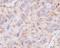 Lysosomal Associated Membrane Protein 2 antibody, M01573, Boster Biological Technology, Immunohistochemistry paraffin image 