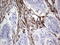 Nuclear Receptor Subfamily 0 Group B Member 1 antibody, M01521-1, Boster Biological Technology, Immunohistochemistry paraffin image 