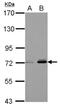 Fermitin Family Member 3 antibody, NBP2-20821, Novus Biologicals, Western Blot image 